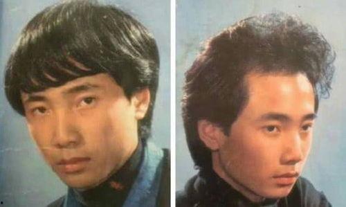 有遗传脱发的明星