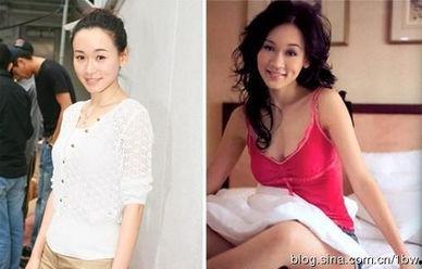 明星隆胸对比照片,明星身材蜕变揭秘